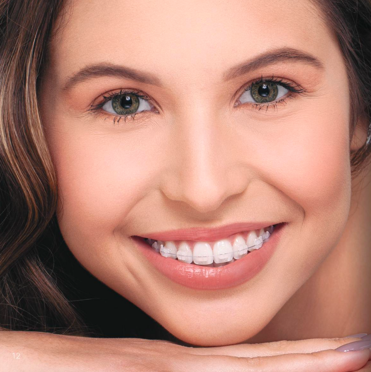 NEW ICERAM - კერამიკული ბრეკეტი