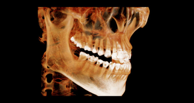 3D აპარატი